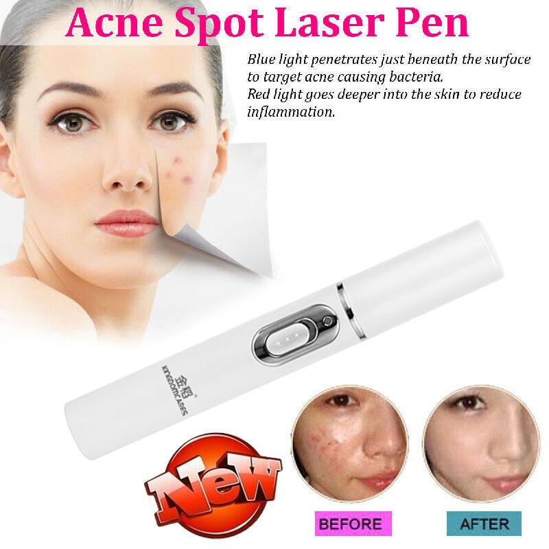 tratament antirid cu laser anexare savoy elvetia anti imbatranire
