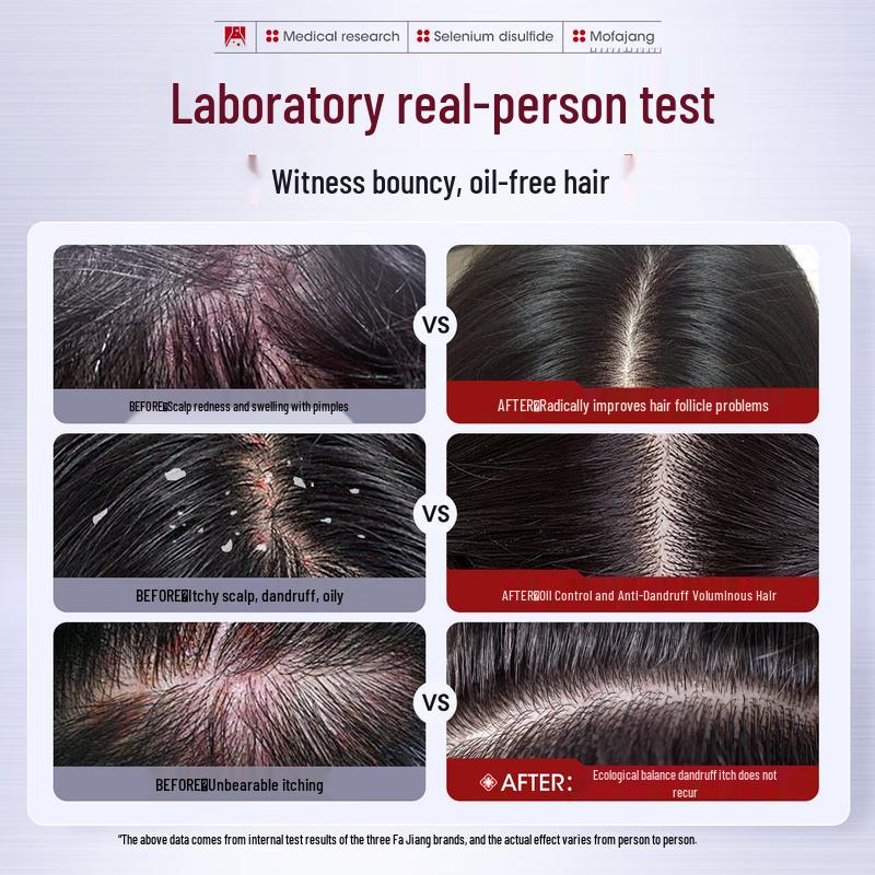 San Ge Mo Fa Jiang Selenium Disulfide Anti-Dandruff Shampoo