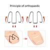 Nail Corrector Ingrown Toe Nail Wire Lifter Fixer Recover Tool Bunion Corrector for Pedicure Foot Care