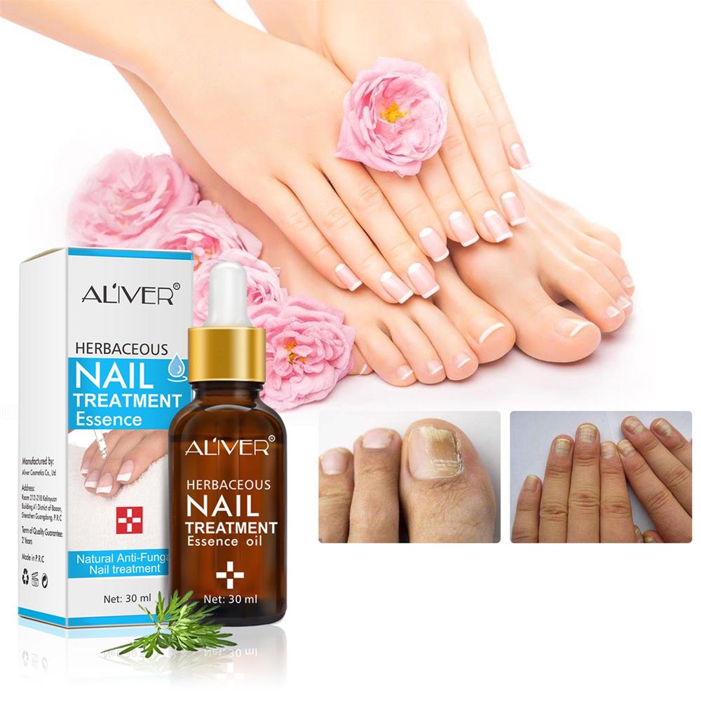 Buy AntiFungal Nail Repairing Essence Foot Whitening Toenail Fungus