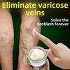 Venoheal Varicose Vein Easy Paste