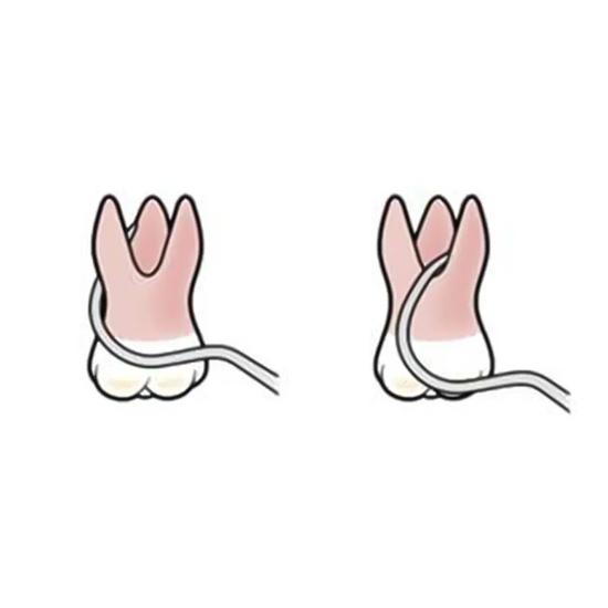 GDC Double End Probes Nabers Color Coded #1 (PQ2N)