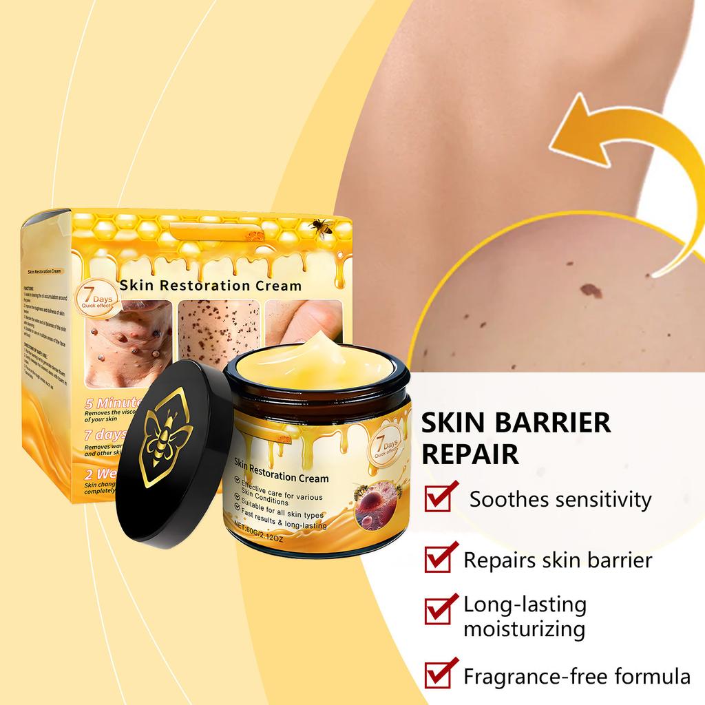 The Skin Cream For Removing s, Combined With Herbal Ingredients, Can Remove s Without Leaving Scar.
