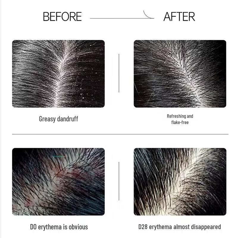 Spēs Bisabolol Polypeptide Anti-Dandruff Shampoo & Conditioner