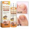 3pcs Bee Venom Nail Treatment Serum Toenail Serum Liquid Nail Growth and Repair 20ml