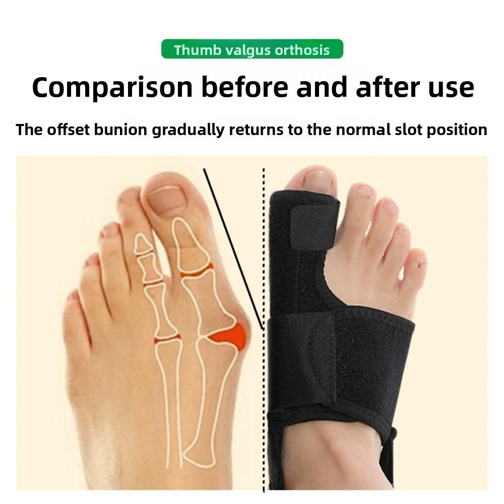 Hallux Valgus Bunion Corrector Orthotics Toe Separator Feet Bone Adjuster Thumb Straightener Pain Relief Pedicure Foot Care Tool