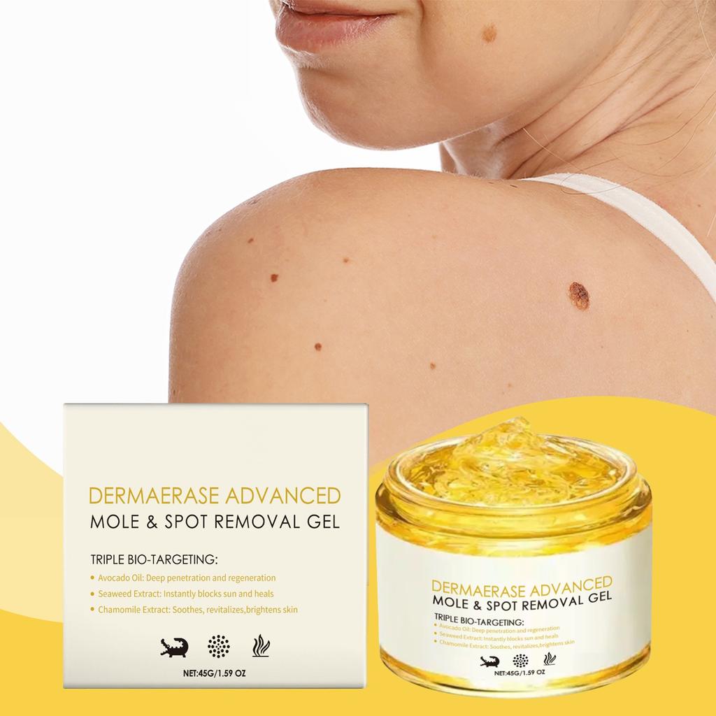 Freckle Removing Nevus Gel Whitening And Rejuvenating Skin Lightening Sun Freckle Brightening Skin Cream