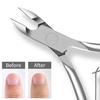 Professionelle Edelstahl-Nagelhautzange - Gold & Silber Entferner für abgestorbene Haut & Hühneraugen für Maniküre- & Pediküre-Werkzeuge