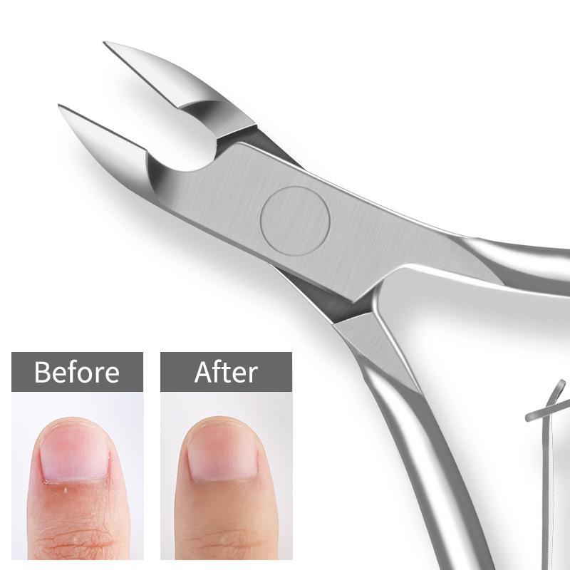 Professionelle Edelstahl-Nagelhautzange - Gold & Silber Entferner für abgestorbene Haut & Hühneraugen für Maniküre- & Pediküre-Werkzeuge