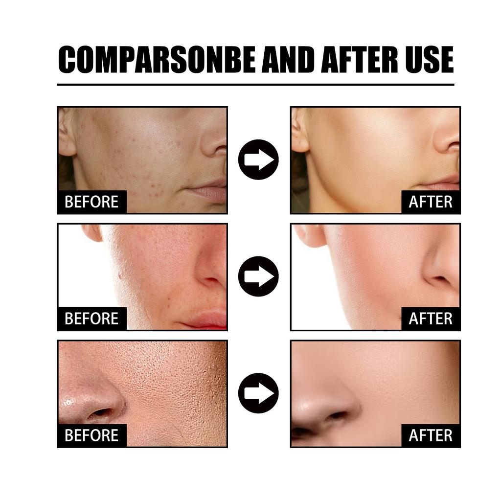 EELHOE Niacinamide Face Serum Whitening Anti Wrinkles Removal Spots Freckle Face Care Sodium Hyaluronate Facial Essence 50ml