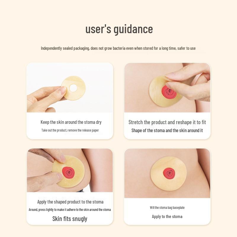 Anneau adhésif moulable étanche pour les soins de stomie - Plaque de base pour accessoire de colostomie