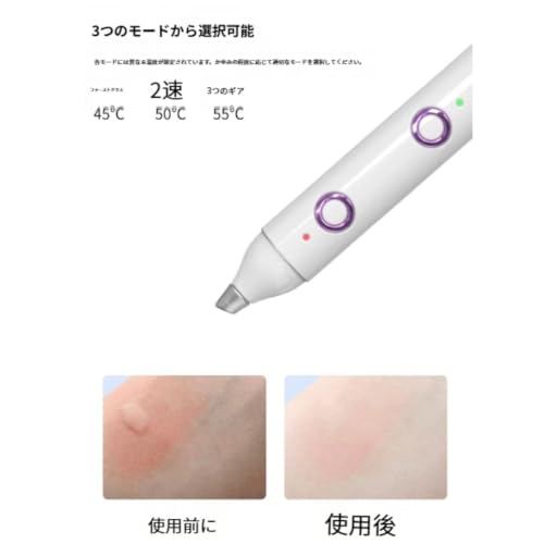 Portable Thermal Itch Relief Pen Electronic Device Home Outdoor Use Selectable from Three Modes Automatic Power Off Timer Function Pure Physical No A)