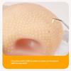 Pimple Toy Silicone Satisfying Pimple Pop Toy Reusable Stress Reliever Nose Game For Kids Boy Girls Adults Classroom Desk