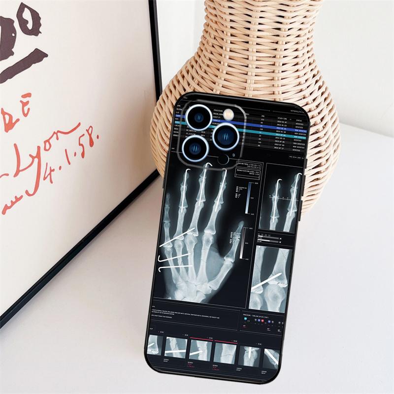 Radiological Human Organs Skeleton Cover Case For iPhone 14 Pro 11 16 15 Pro Max 12 13 Mini Plus XS X XR Funda