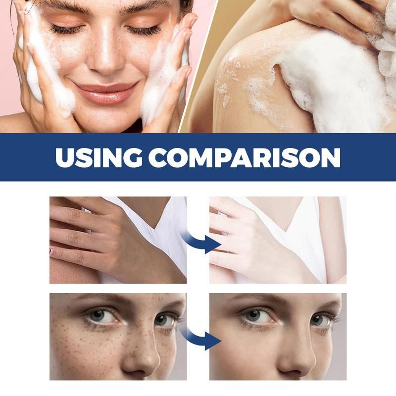 Jaysuing Spot Cleanser Lotion 150ml For Deep Facial And Body Cleansing To Brighten And Fade Spots