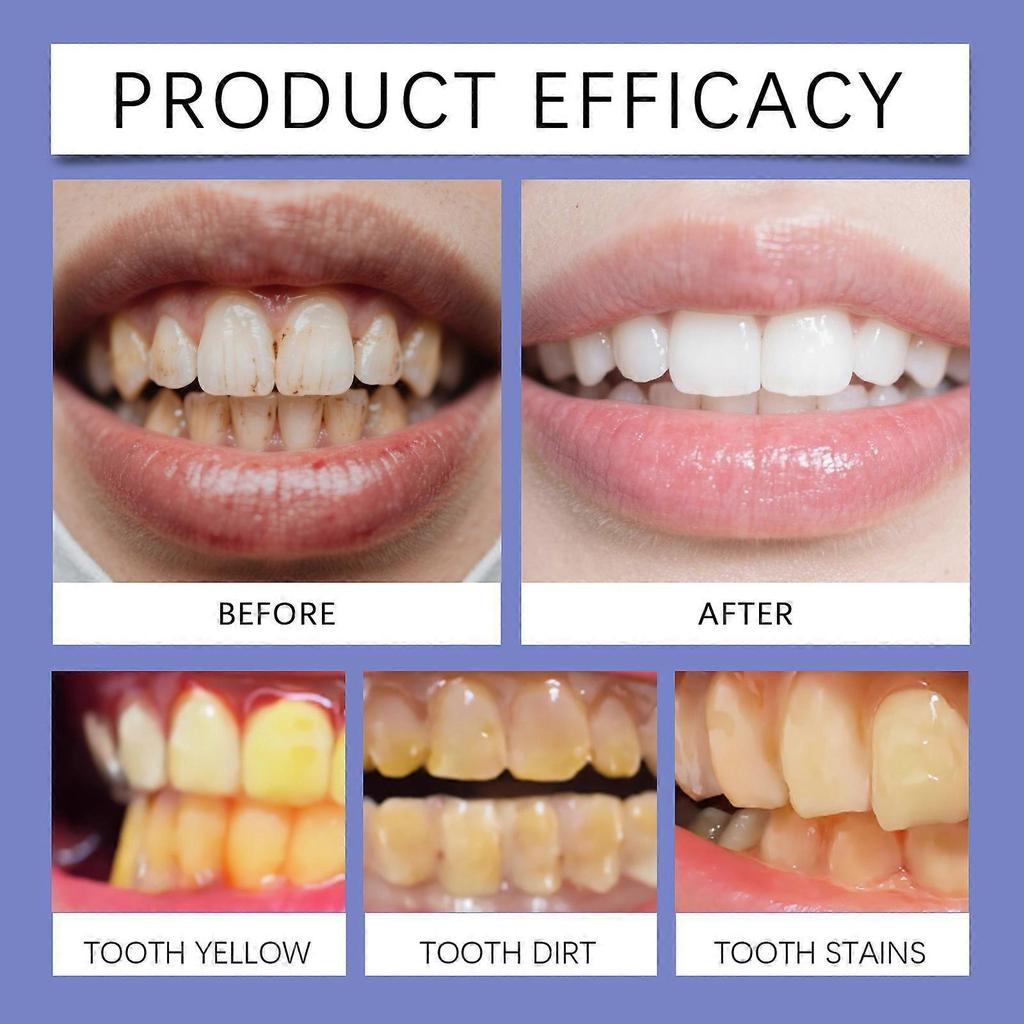 Niacinamide Whitening Toothpaste, Toothpaste for Fresh Breath, Removes Toothstains, Enamel Suitable,120g/4.23Oz