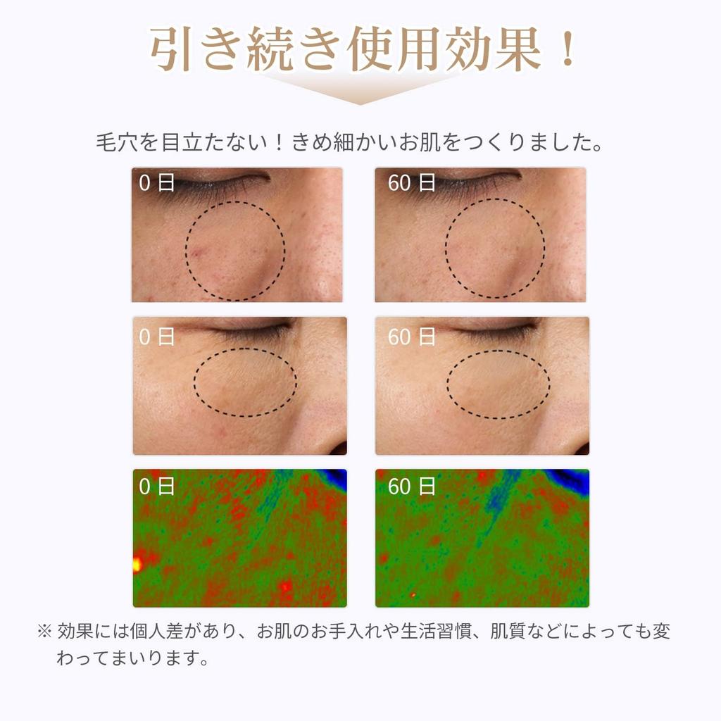 ANLAN LED Facial Facial Beauty Light 5 Color LED Thermal Facial Thermal Light Beauty IPX5 Facial Beauty Device for Home Skin Face Japanese Instruction