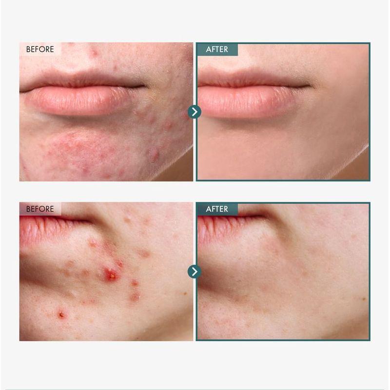 TOSOWOONG Adenosine Cica Cream