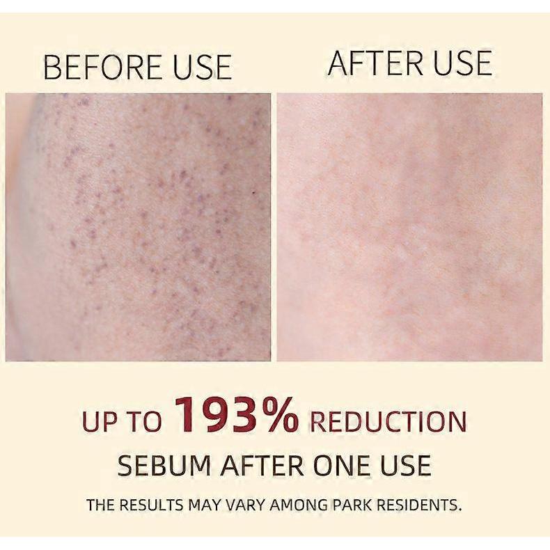 Peel Shot Glow Rice Peeling Ampoule White Rice Ampoule + Black Rice Ampoule Set, Soft Exfoliating Face & Body Scrub Dead Skin, Blackheads Remover for