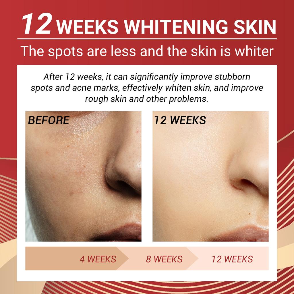 Acerola Cherry Skin Beauty Serum, Brightening And Dull Skin Tone, Moisturizing Repair, Moisturizing And Shining Skin Rejuvenation