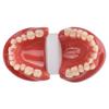 Dental Lab Teeth Malocclusion Model Demonstration Model for Training Studying Teaching Oral Model Dentistry Tools