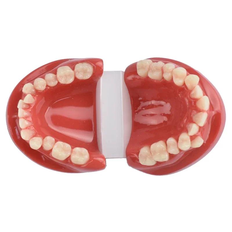 Dental Lab Teeth Malocclusion Model Demonstration Model for Training Studying Teaching Oral Model Dentistry Tools