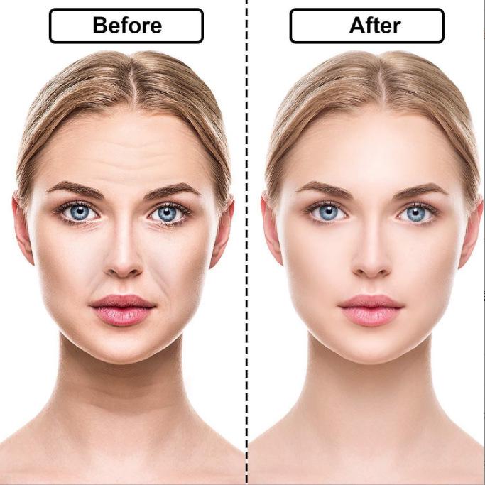 16-Piece Silicone Anti-Wrinkle Stickers for Face: Forehead, Eye, and Neck, Plus 11-Piece T-Shaped Chest Set