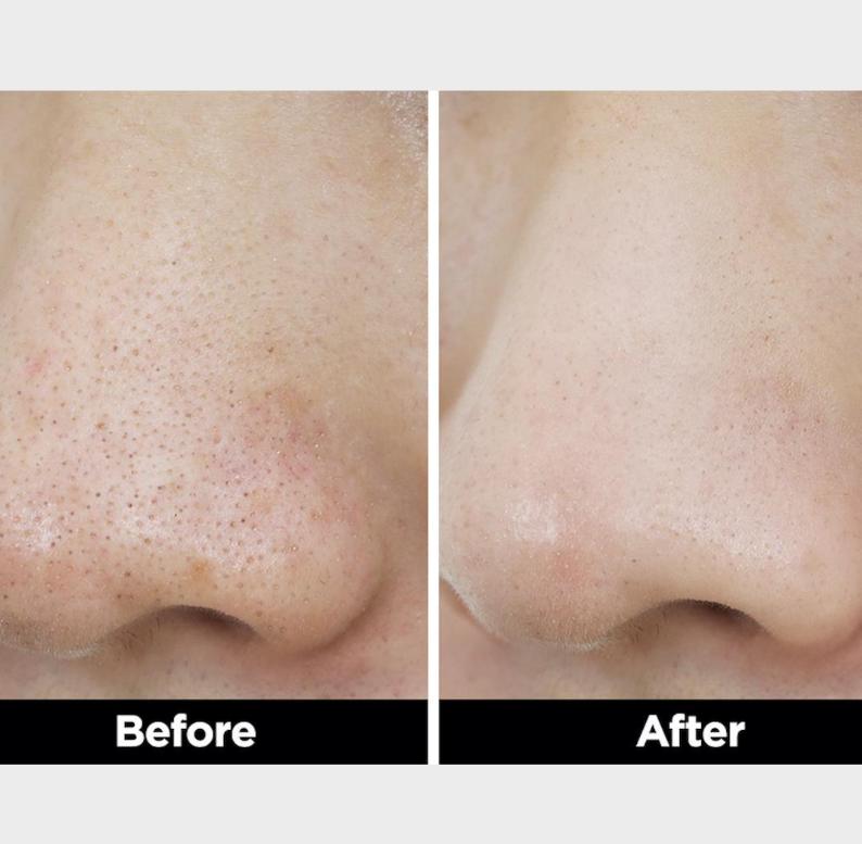 Manyo Factory Reinigungsöl 200ml – Pur / Kräutergrün für Akne & Empfindliche Haut