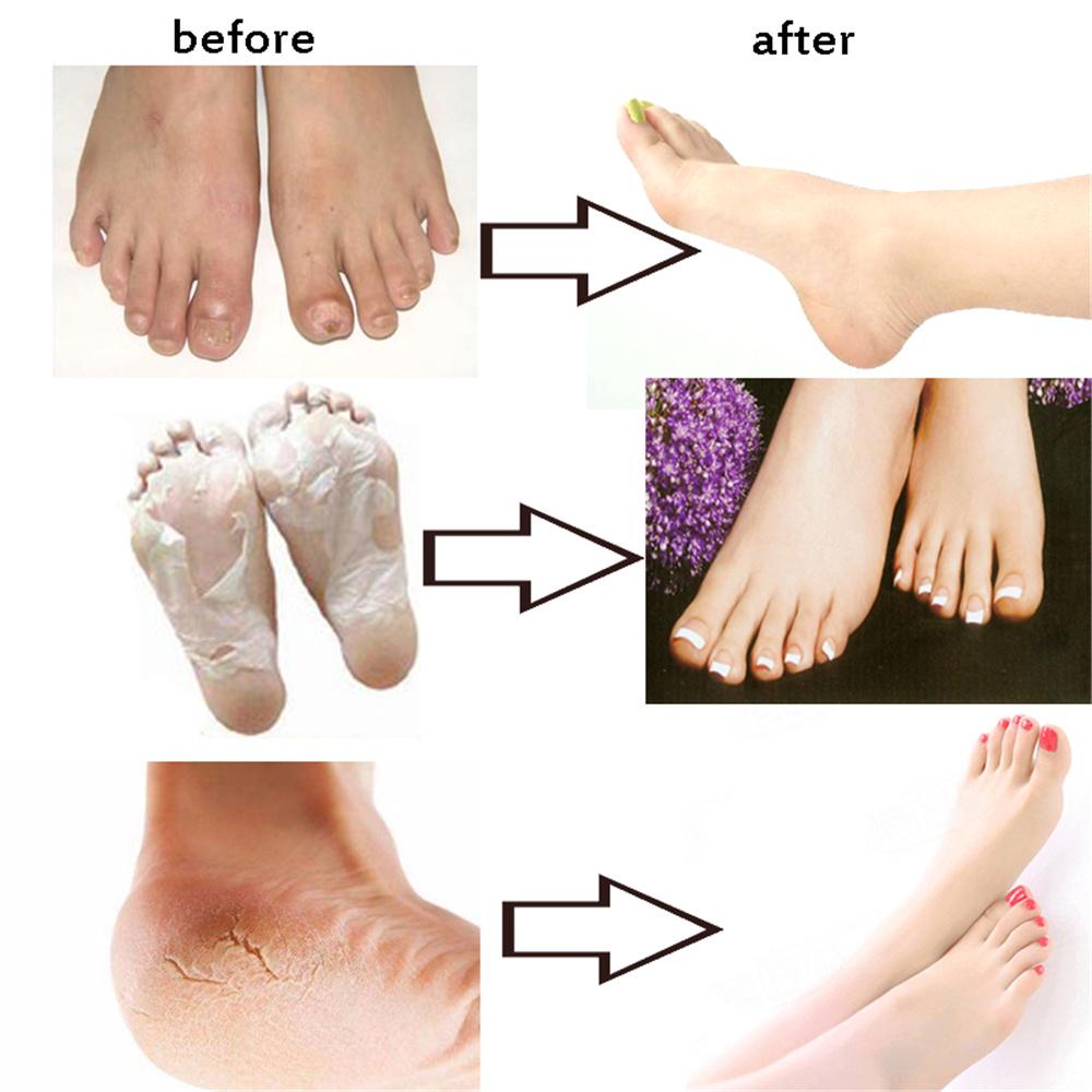 Planet Pharma Balsamo Plus Per Piedi Secchi E Screpolati - Foto 5