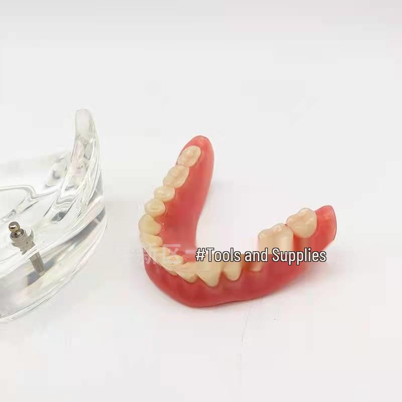 Modelo Dental de Media Mandíbula con Demostración de Implante Dental y Restauración de Dentadura Postiza