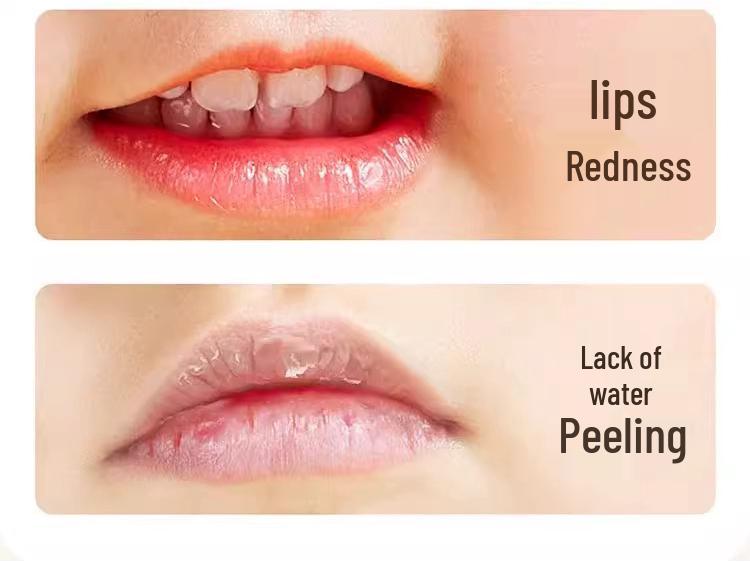 Daikosi Kinder Feuchtigkeitsspendender Lippenbalsam – Hydratisierende Pflege für Jungen und Mädchen