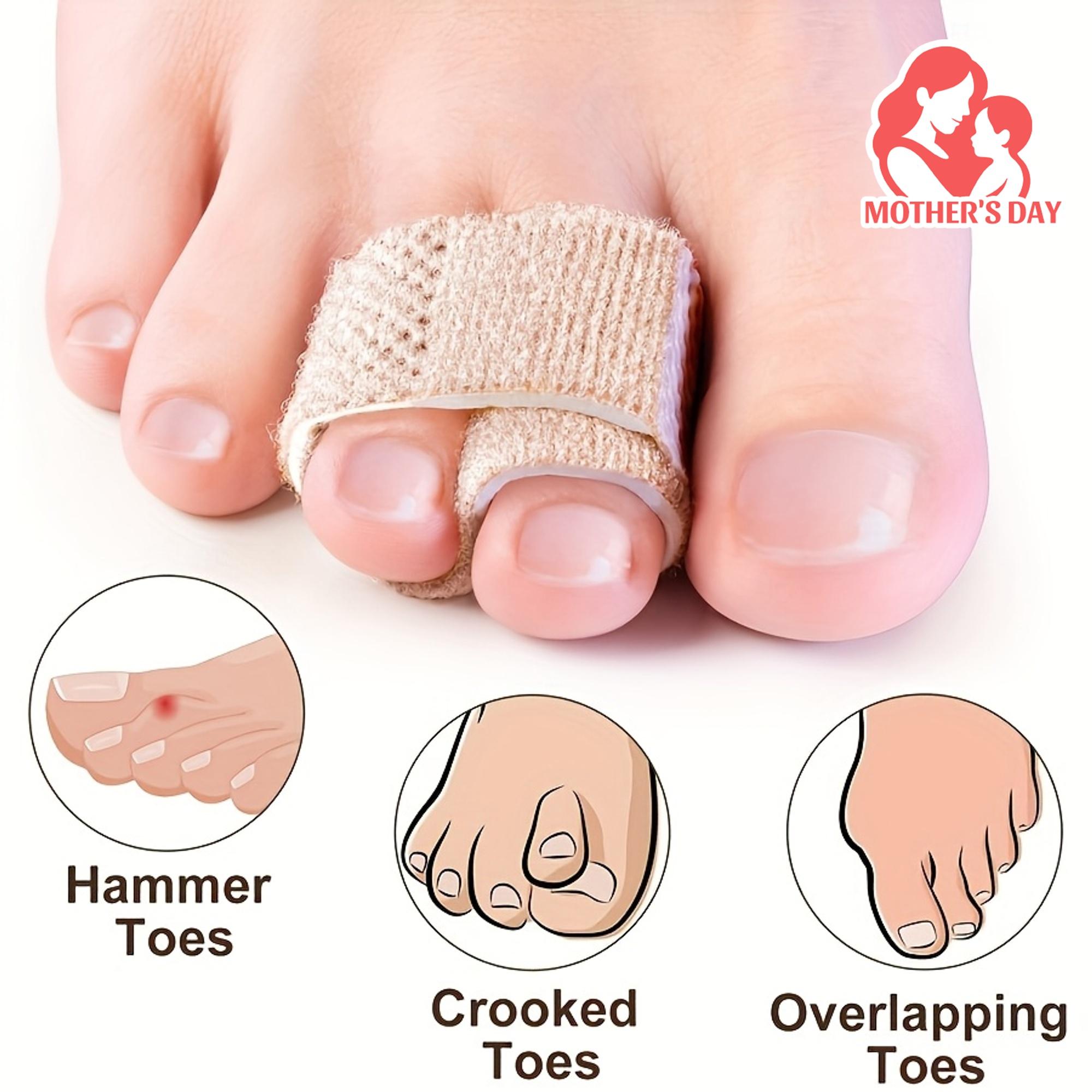 

2pcs Adjustable Toe Support Braces - Reusable Polyester Fracture Straps for Hammer, Crooked & Overlapping Toes