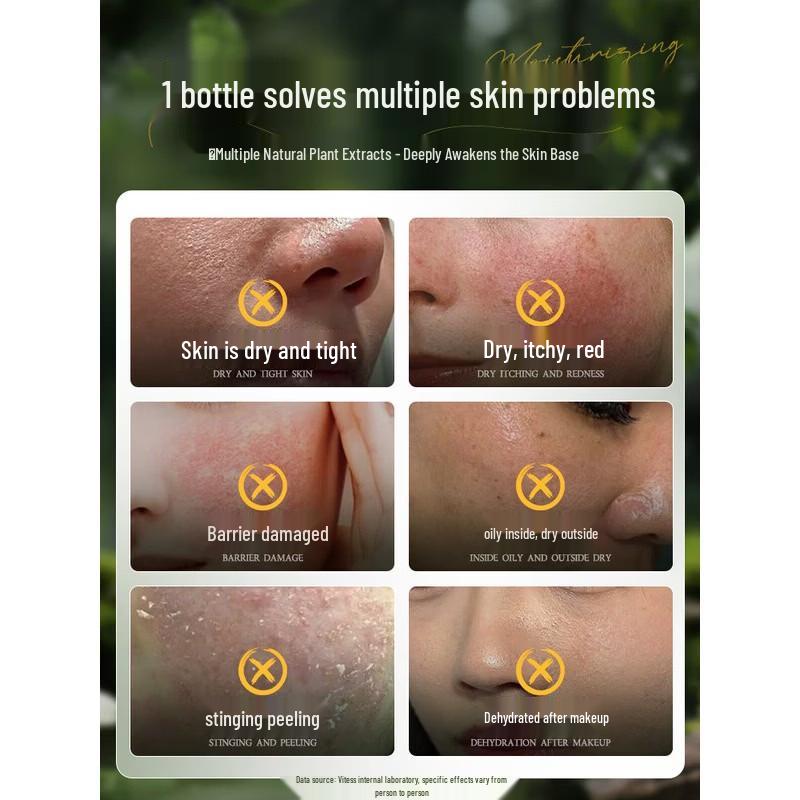 Vitas Centella Asiatica Hydrating Facial Mist 300ml