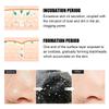 Nasal Sticker Bamboo Charcoal To Remove Blackheads and Acne To Clean Pores To Absorb Grease and Dirt Nasal Membrane