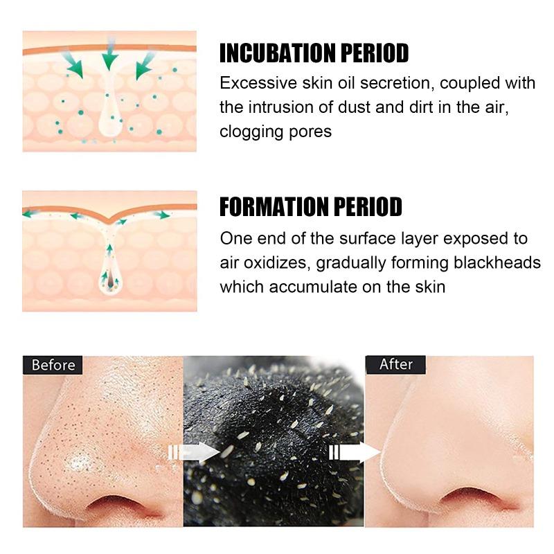 Nasal Sticker Bamboo Charcoal To Remove Blackheads and Acne To Clean Pores To Absorb Grease and Dirt Nasal Membrane