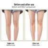 Silicone Straight Leg Corrective Stickers for Bow Legs and Knock Knees - Seamless Design for Comfortable Boot Wear.