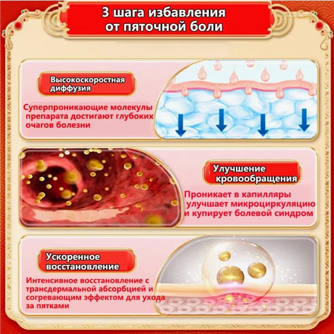 Chinese Ointment for Heel Spurs and Heel Pain