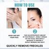 EELHOE Whitening Freckle Cream Nicotinamide Dark Spot Remover Moisturizing Skin Care Brightening Anti-Aging Face Beauty Care 50g