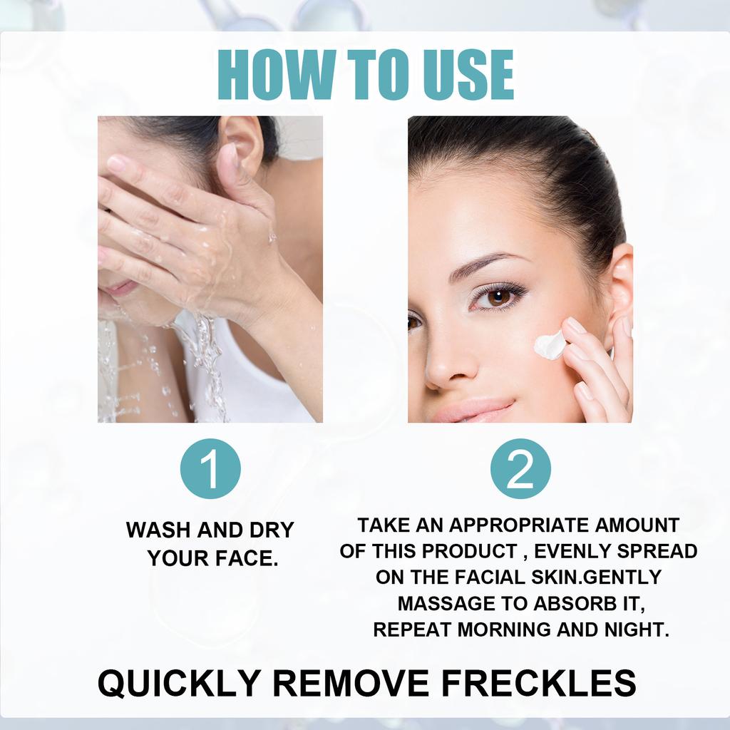 EELHOE Whitening Freckle Cream Nicotinamide Dark Spot Remover Moisturizing Skin Care Brightening Anti-Aging Face Beauty Care 50g