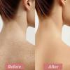 Strawberry Skin Treatment, Strawberry Legs Resurfacing Cream with Brush, Advanced Triple-Acid Complex, Reduce Chicken Skin Bumps
