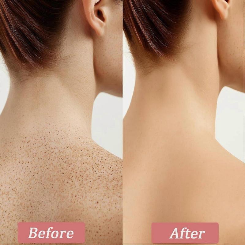 Strawberry Skin Treatment, Strawberry Legs Resurfacing Cream with Brush, Advanced Triple-Acid Complex, Reduce Chicken Skin Bumps