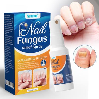 Sumifun Sprej na ošetření nehtů, Antifungální roztok na opravu a rozjasnění nehtů pro péči o nehty na nohou