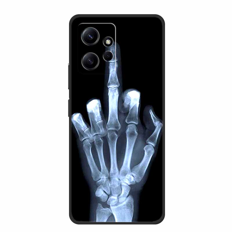 Für Xiaomi Redmi Note 12 4G Hülle Tiere Weiches Silikon TPU Handyhüllen Rückseite für Redmi Note12 4G Mode 23021RAA2Y Fundas