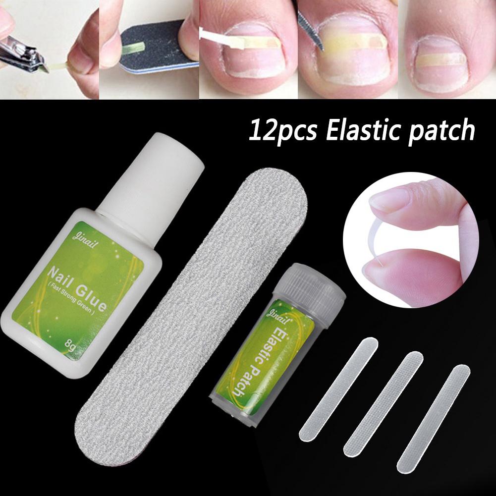 Clinging 12Pcs Ingrown Toenail Correction Pedicure Tool Elastic Patch Straightening Clip