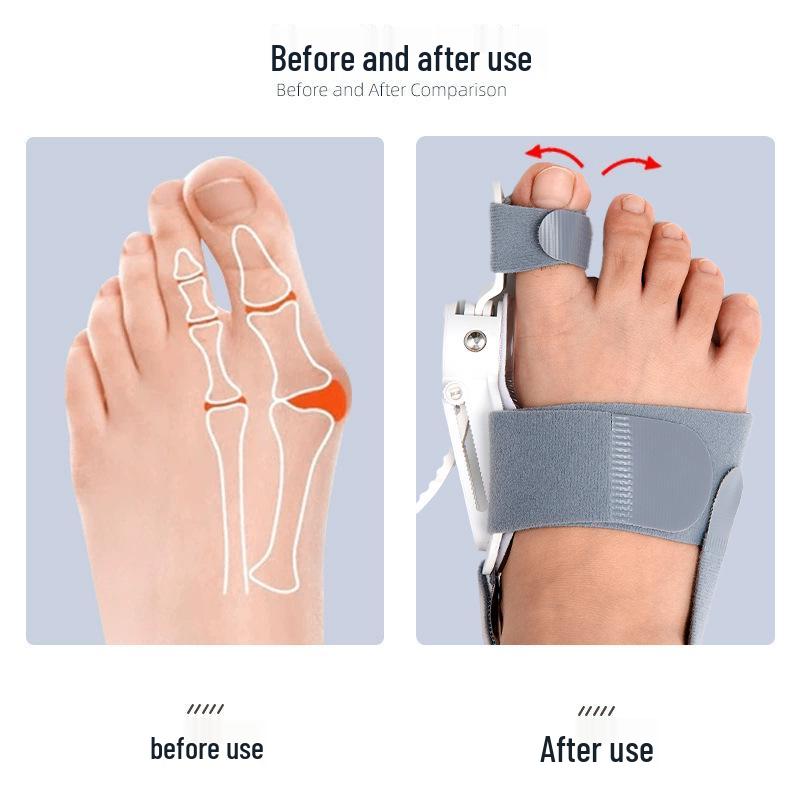 Hallux und Großzehen-Orthese Korrekturgerät