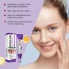 Whitening Freckle Cream Melasma Dark Spots Pigmentation Removal Product Fade Stain Melanin Fast Repair Brighten Korean Skin Care
