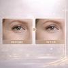 Retinol Eye Cream 20g, Anti-Wrinkle & Tightening, Reduces Dark Circles, Hydrates Eye Area