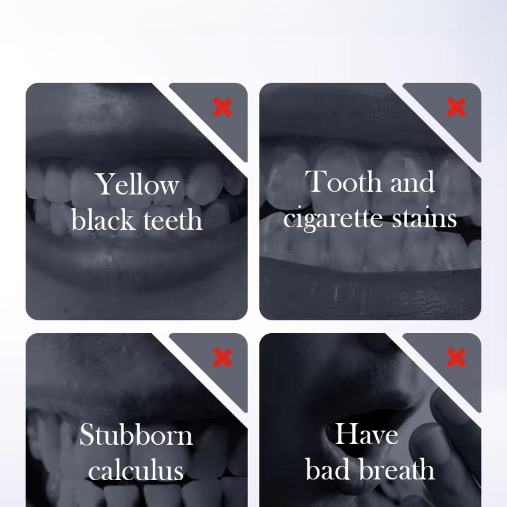 Baking Soda Probiotic Whitening Toothpaste To Remove Yellow Teeth Stains and White Teeth Removal Clean Teeth Fresh Mouth 300g