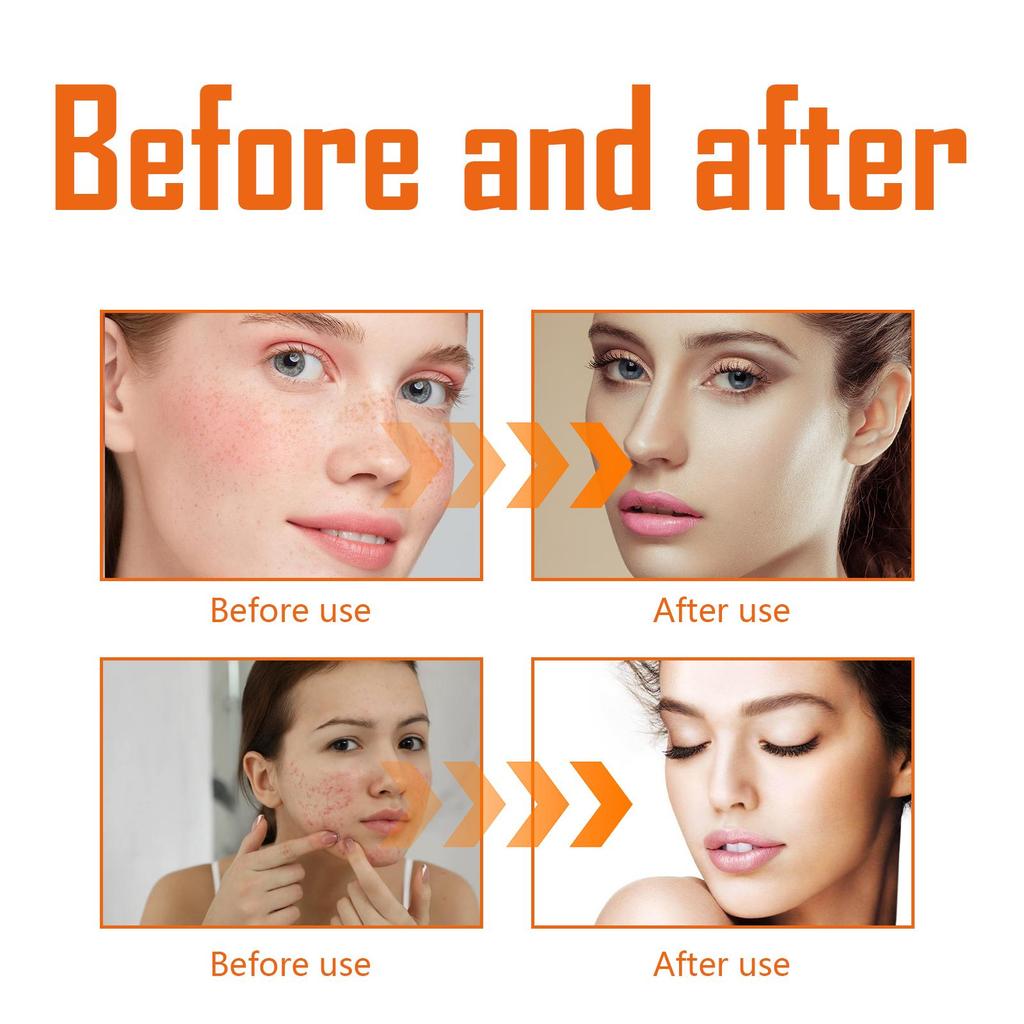 West&Month Anti-Dark Turmeric Toner ,Deeply Hydrates and Moisturizes, Brightens and Firms Facial Skin, Suitable for Face 100ml