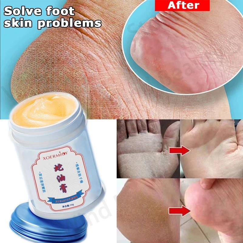 Snake Oil Moisturizing Cream for Dry Skin Relief Deep Hydration Body Balm for Cracked Skin Care 30g